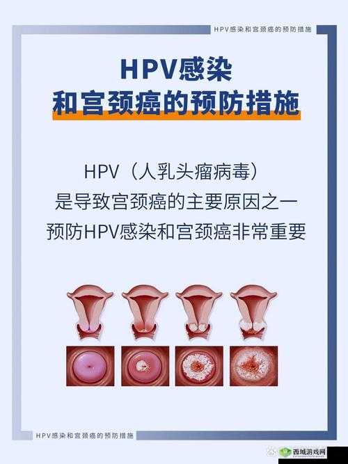 和几个人发生过关系才会得HPV：真相探究